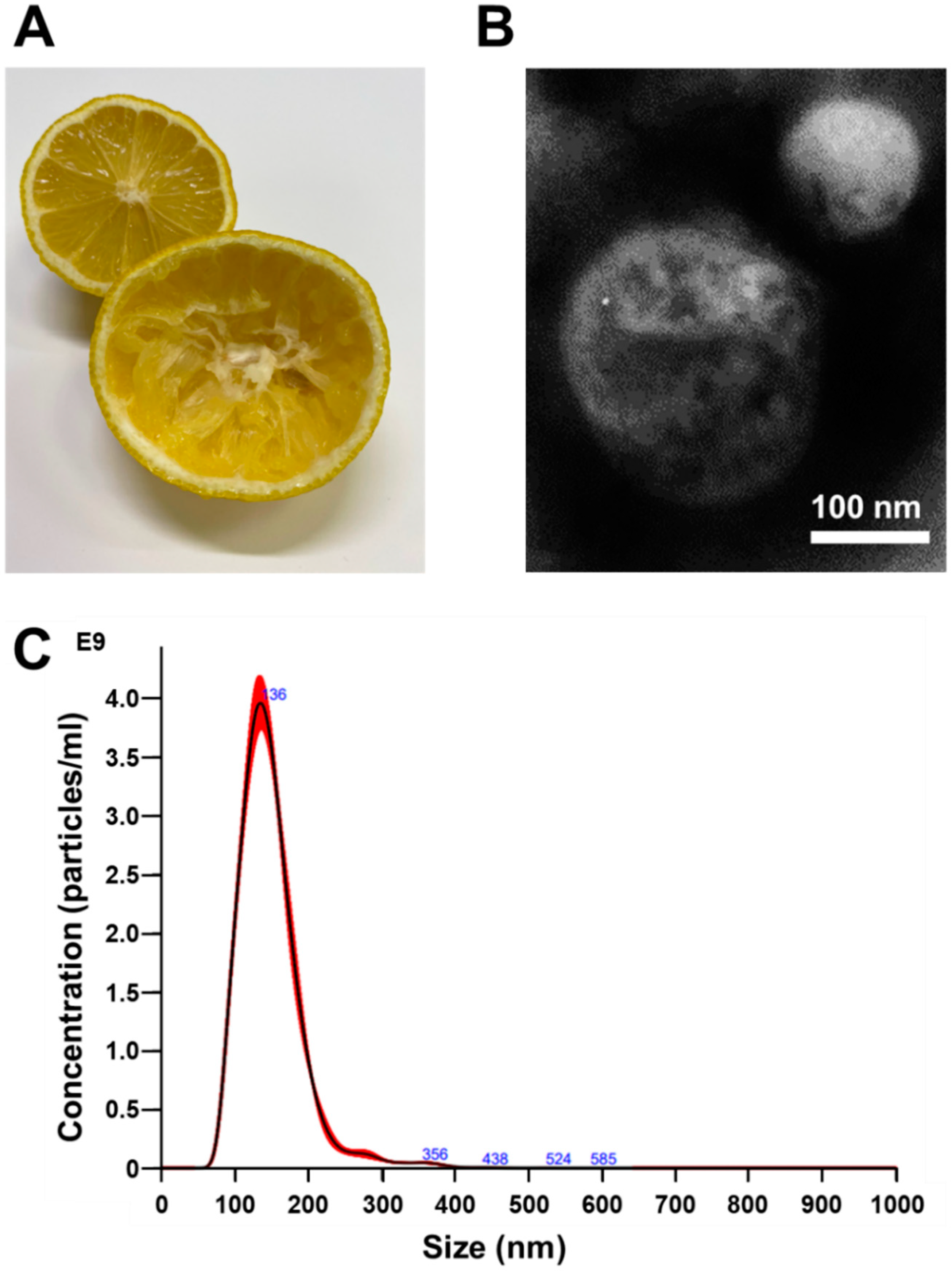 Characterization of Citrus limon-Derived Nanovesicles by TEM and NTA.